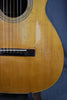 1962 Martin 00-21NY New Yorker