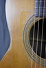 1962 Martin 00-21NY New Yorker