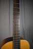 1962 Martin 00-21NY New Yorker