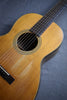 1962 Martin 00-21NY New Yorker