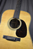 Martin D-28 Billy Strings